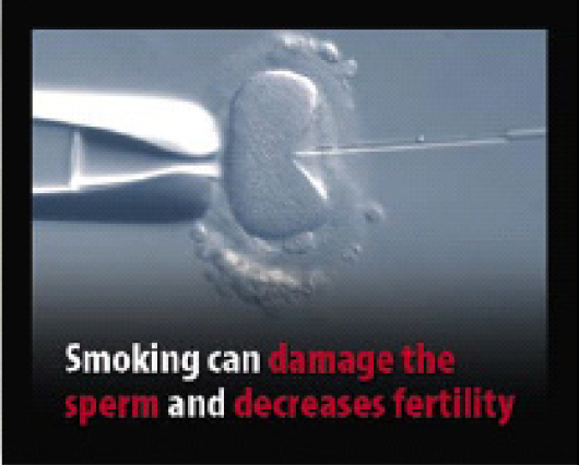 EU 2004 Health Effects sex - sperm image, infertility